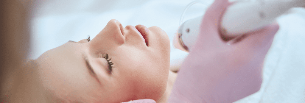 Dermaforce Microneedling with RF